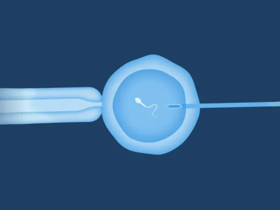 assisted-reproductive-tech